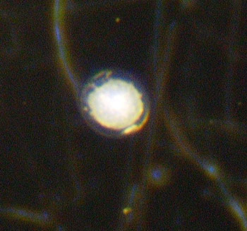 Thawed Embryo in 50 freeze