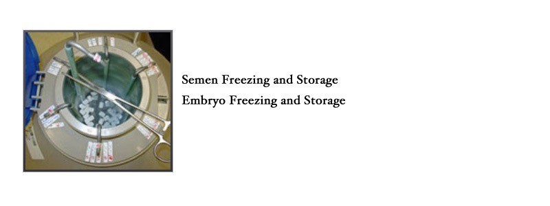 cryogenic services home